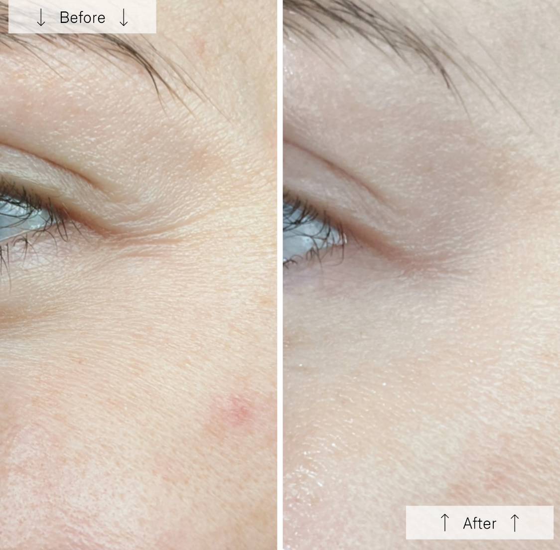 Omnilux Contour Face LED Mask (PRE-ORDER!)